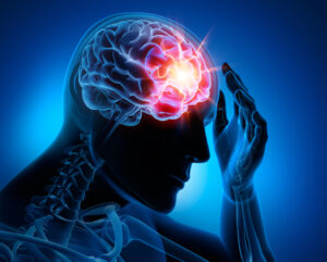 How Hale Injury Lawyers Can Help If You’ve Suffered a TBI in Lake Charles, LA