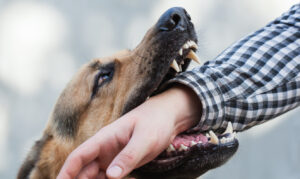 Why Should I Hire Hale Injury Lawyers After a Dog Bite in Lake Charles, LA?