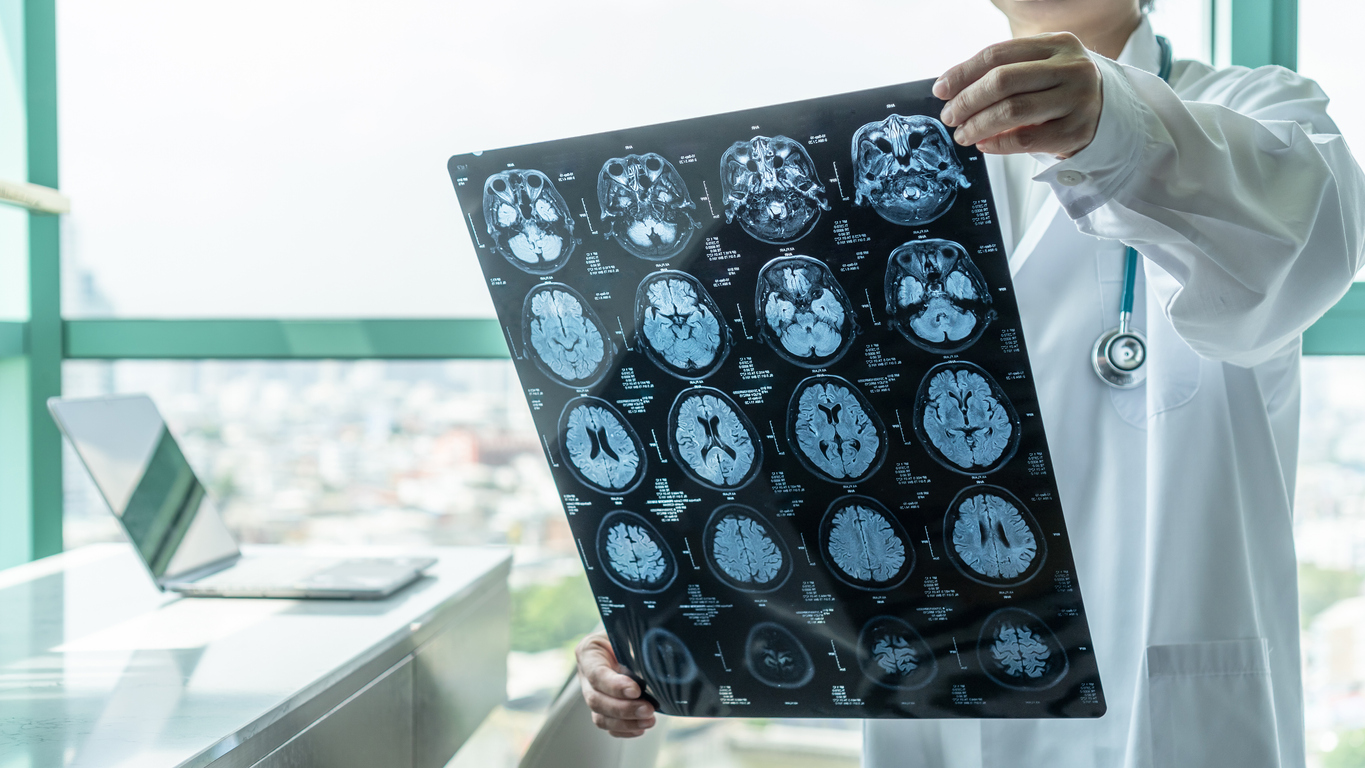 4 Types of Brain Injuries and 3 Levels of Severity | Lake Charles, LA ...