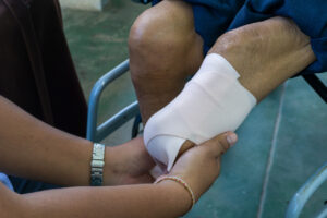 Amputation Injuries